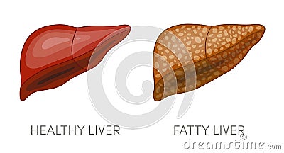 Fatty liver disease Cartoon Illustration