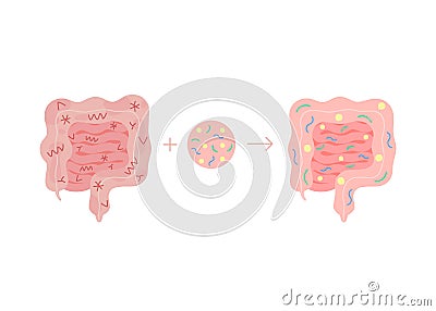 Fecal microbiota transplant from healthy in unhealthy intestine, FMT. Improvement intestinal microflora and Vector Illustration