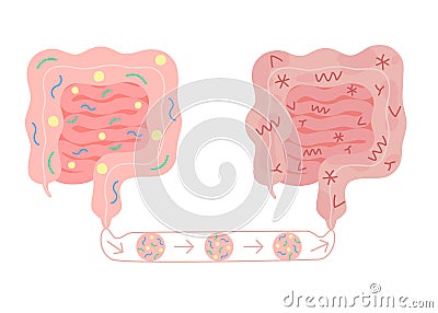 Fecal microbiota transplant from healthy in unhealthy intestine, FMT. Improvement intestinal microflora and Vector Illustration