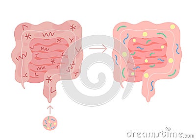 Fecal microbiota transplant from healthy in unhealthy intestine, FMT. Improvement intestinal microflora and Vector Illustration