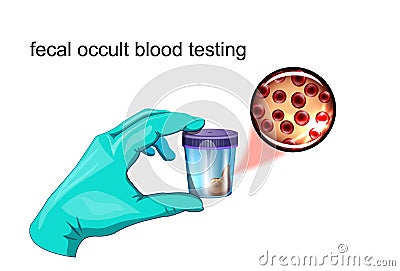 Fecal occult blood testing Vector Illustration