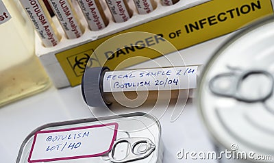 Fecal sample of a person infected with botulism, infection in tin cans in poor condition Stock Photo