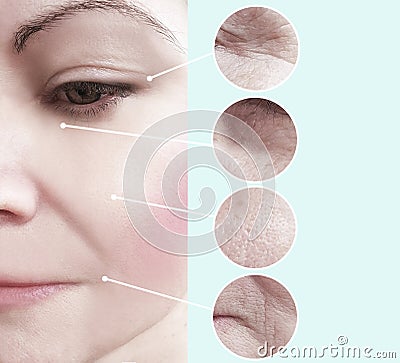 Female beauty wrinkles before after regeneration difference collage beautician effect tension Stock Photo