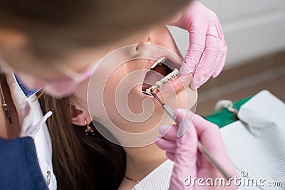 Female dentist checking up patient teeth with metal brackets at dental clinic office. Medicine, dentistry Stock Photo