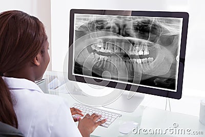 Female dentist examining jaw xray on computer in clinic Stock Photo