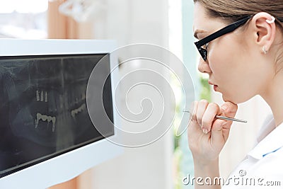 Female dentist looking teeth on digital X-Ray computer monitor Stock Photo