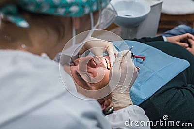 Female dentist with a patient in her office. Patient with open mouth and woman dentist working. dental health concept Stock Photo