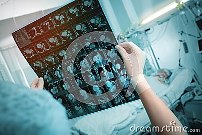 Female doctor carefully examines a CT scan against the background of a patient lying in bed in the emergency room Stock Photo
