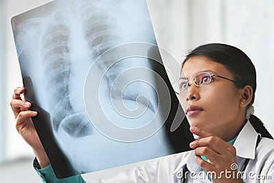 Female doctor checking xray image Stock Photo
