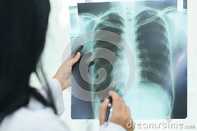 Female doctor examining about lungs with x-ray film - sick concept. Stock Photo