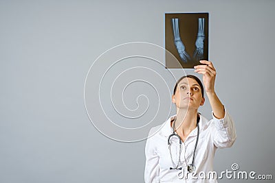 Female doctor examining x-ray image of legs of newborn baby Stock Photo