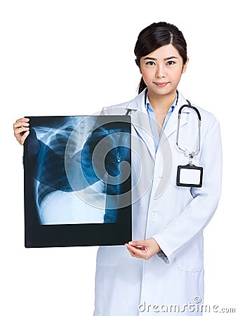 Female doctor holding x-ray film Stock Photo