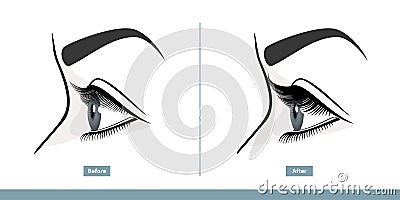 Female Eye Before and After Eyelash Extension. Comparison of Natural and Volume Eyelashes. Side View. Infographic Vector Vector Illustration