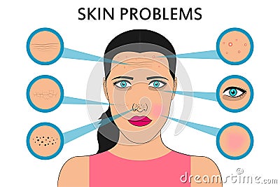 Female face skin problems. Acne and pimples, black spots, redness, dryness, circles under the eyes and wrinkles. Vector. Vector Illustration