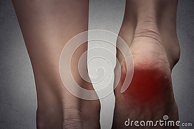 Female foot heel pain colored in red Stock Photo