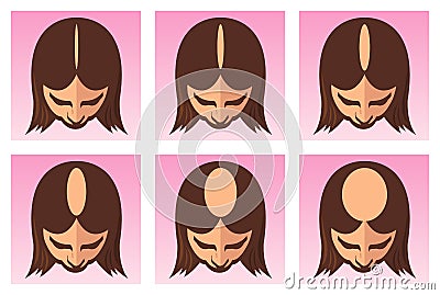 Female hair loss illustration Vector Illustration