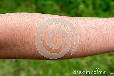 Female with hairy arm Stock Photo