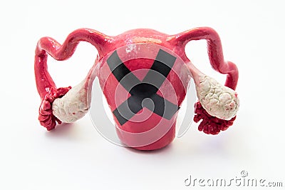 Female infertility concept. Model of female uterus with ovaries with black prohibiting cross on it. Photo symbolizing female infer Stock Photo