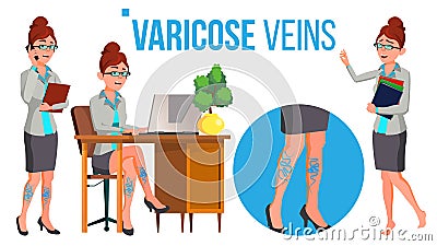 Female Legs In High Heel Shoes With Varicose Veins Vector. Isolated Cartoon Illustration Vector Illustration