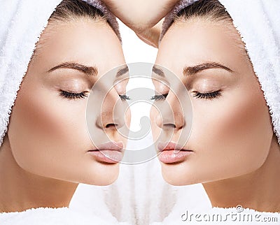 Female nose before and after cosmetic surgery. Stock Photo