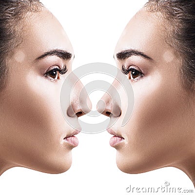 Female nose before and after cosmetic surgery. Stock Photo