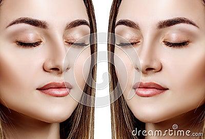 Female nose before and after cosmetic surgery. Stock Photo