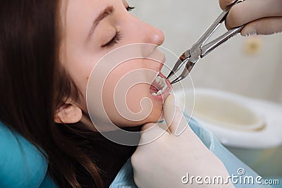 Female patient with dentist and assistant - dental treatment. Concept of healthy Stock Photo