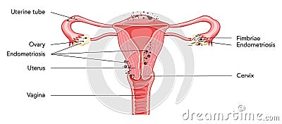 Female reproductive system uterus diagram with inscriptions in Latin text. Front view in a cut. Human anatomy internal Vector Illustration