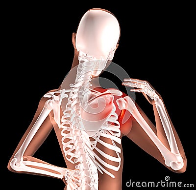 Female skeleton with shoulder pain Stock Photo