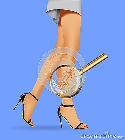 Female slim legs and varicose Cartoon Illustration