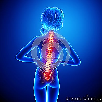 Female spine pain Stock Photo