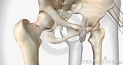 A femoral neck fracture is a type of hip fracture that occurs in the section of the femur closest to the pelvis Stock Photo