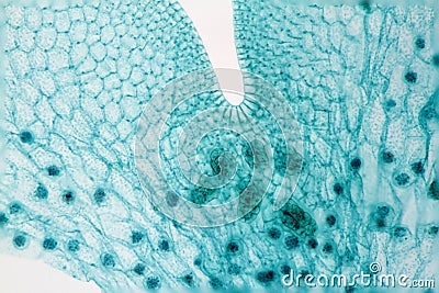 Fern prothallium - reproductive organs Stock Photo