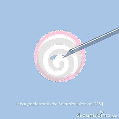 Fertility reproduction of ovum and spermatozoon ICSI Vector Illustration