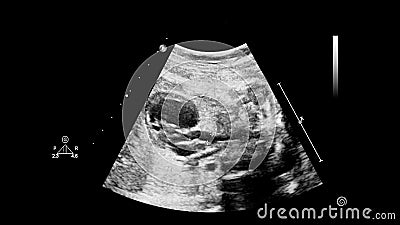 Ultrasound screen with fetal echocardiography Stock Photo