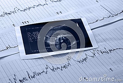 Fetus and electrocardiogram test Stock Photo