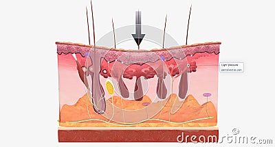 With fibromyalgia, nerves become hypersensitive to external stimuli, a change known as central sensitization Stock Photo