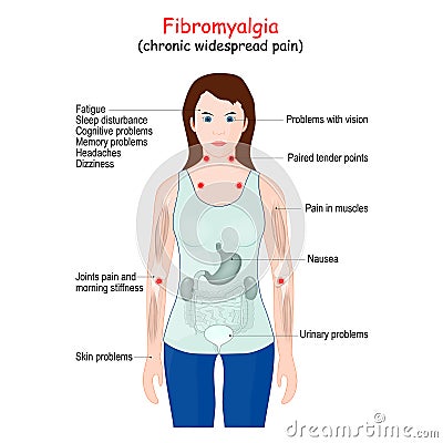 Fibromyalgia Signs and symptoms Vector Illustration