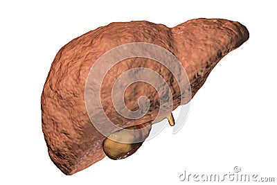 Fibrotic liver illustration Cartoon Illustration