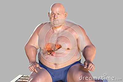 Fibrotic liver in obese man, 3D illustration Cartoon Illustration