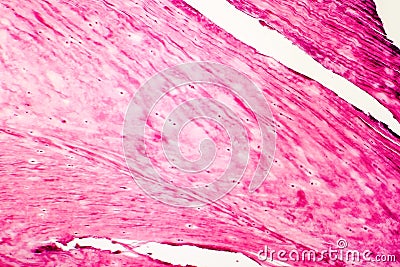 Fibrous cartilage, light micrograph Stock Photo