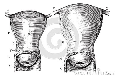 Fig. 1229. Uterus virgin women, seen by its anterior aspect, Fig Vector Illustration