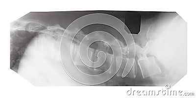 Film with X-ray image of side view of human spine Stock Photo