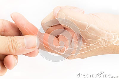 Finger bone pain Stock Photo