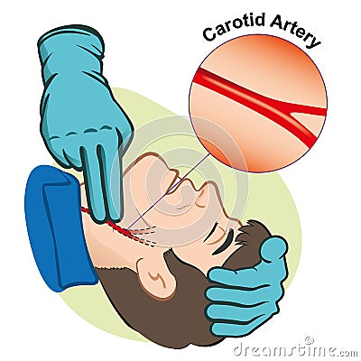 First Aid illustration person measuring pulse through the carotid artery with gloves Vector Illustration