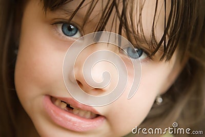 First missing tooth Stock Photo