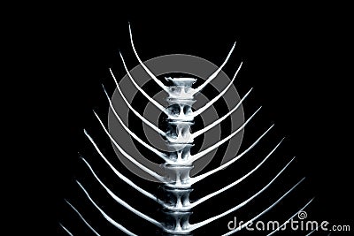 Fishbone series [2] Stock Photo