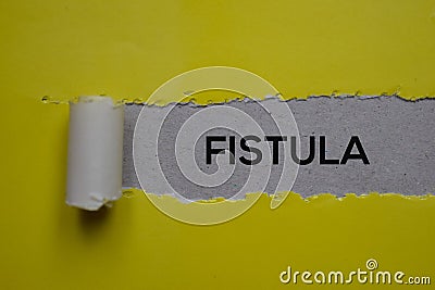 Fistula Text written in torn paper. Medical concept Stock Photo
