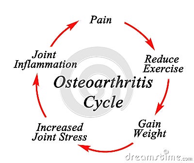 Components of Osteoarthritis Cycle Stock Photo