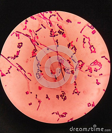 yeast cells and hyphae in gram stain fine with microscope. Stock Photo